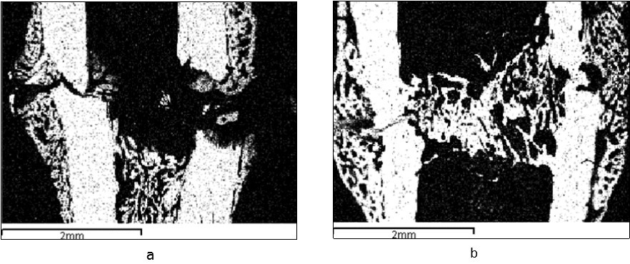 A tibia fracture zone in the animals from the control (a) and experimental (b) groups (3 sessions of laser therapy) 7 days after the operation. Images in the characteristic X-ray radiation of calcium atoms