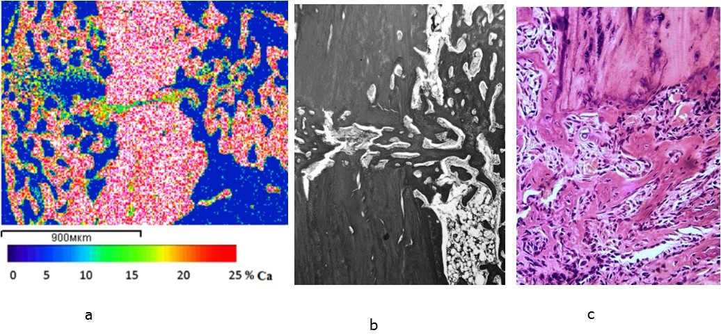 The calcium content (a) and the structure (b, c) of regeneration in the zone of the tibia fracture fusion in the animals of the experimental group 7 days after the operation; a – images in the characteristic X-ray radiation of calcium atoms, b – light microscopy of histological sections, staining by Van Gieson (b) and hematoxylin-eosin (c), lens 10, eyepiece 10