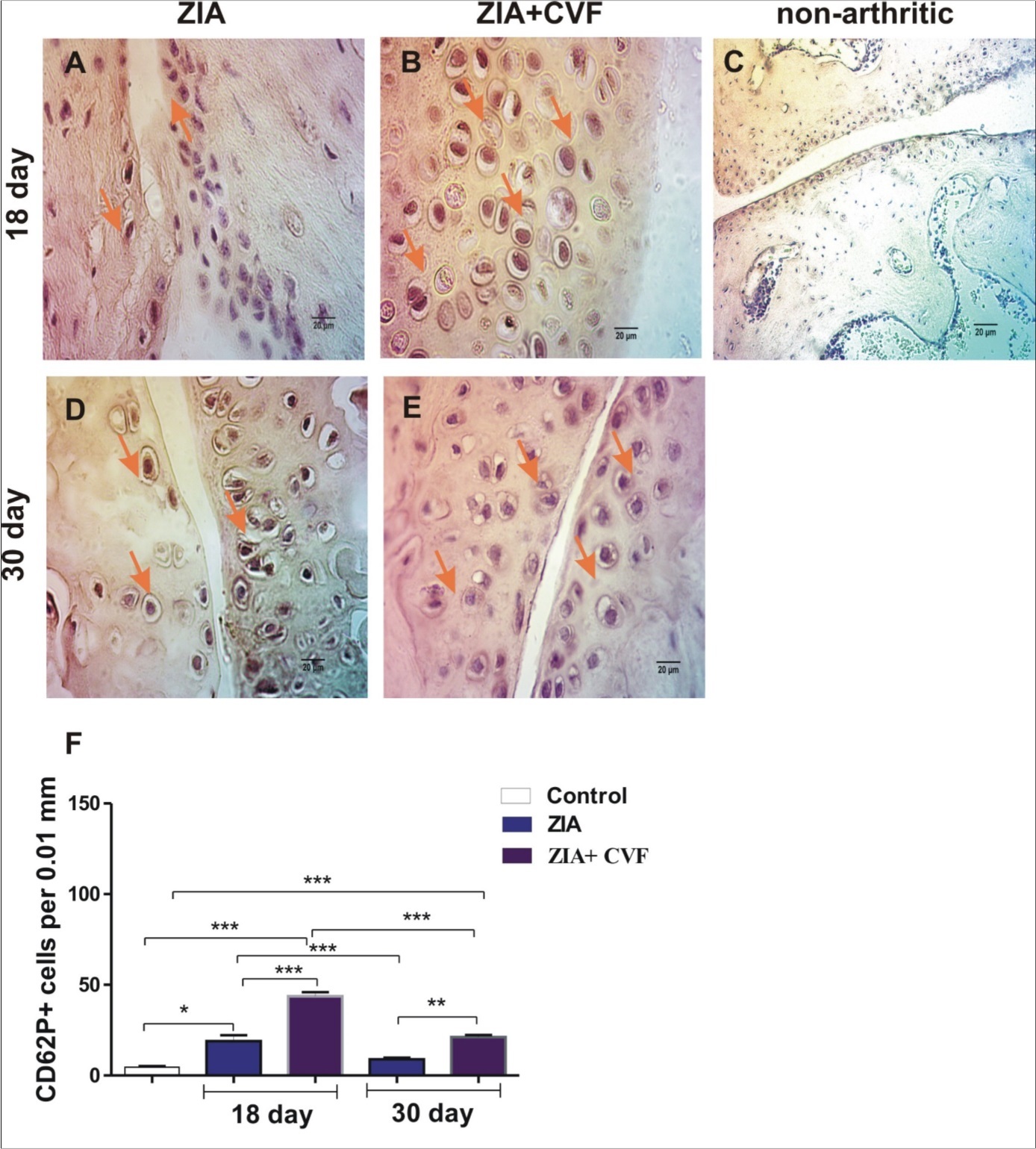 Histochemically stained CD62P+ cells in the cartilage. (A) arrow showed stained CD62P+ cells in ZIA at day 18; (B) arrows showed stained CD62P+ cells in ZIA+CVF at day 18; (C) non-arthritic group; (D) ) arrow showed stained CD62P+ cells in ZIA at day 30; (E) arrows showed stained CD62P+ cells in ZIA+CVF at day 30; (F) graphic presentation of results, scale bar - 20µm, *p<0.05, **p<0.01, ***p<0.001, two way ANOVA.