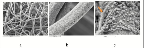 A mesh design made of titanium nickelide implanted into the defect of the metaphysis of the femur: a - general view of the implant, b - microrelief of the surface layer of the implant filament, c - adhesion of malodifferentiated cells and newly formed capillary terminals (arrow) on the surface of the filament 7 days after the operation. Scanning electron microscopy, magnification: a - × 13, b - × 190, c - × 475.