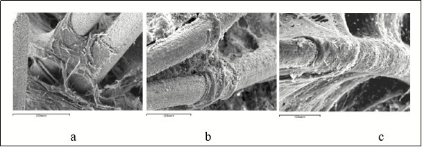 Connective-tissue cover on the implant surface in the defect periosteal zone 7 (a) and 14 (b, c) days after surgery. Scanning electron microscopy, magnification × 160.