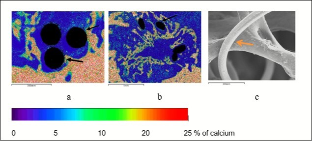Reparative osteogenesis in the metaphyseal defect 7 (a) and 14 (b, c) days after surgery, arrows indicate the areas of osteointegration; a, b – maps of x-ray electron probe microanalysis, image in characteristic X-ray emission of calcium atoms, c – scanning electron microscopy (organic components removed with 6% sodium hypochlorite solution), magnification: а - × 100, b - × 25, c - × 70.