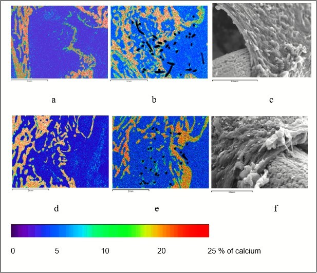Reparative bone formation in the defect of femoral metaphysis in the control (a, d) and experimental (b, c, e, f) group of animals; a, b, c - 30 days after operation; d, t, f - 60 days after operation; a, b, d, e – maps of x-ray electron probe microanalysis, image in characteristic X-ray emission of calcium atoms, magnification × 20; c, f – scanning electron microscopy, magnification: c - × 670, f – 800.