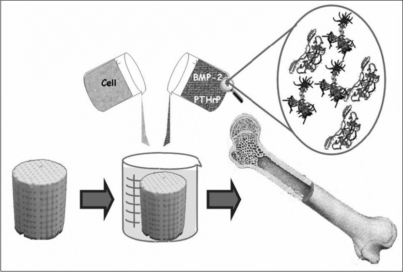 A schematic view of a third generation biomaterial, in which porous CaPO4 bioceramics acts as a scaffold or a template for cells, growth factors, etc. Reprinted from Ref. 65 with permission.