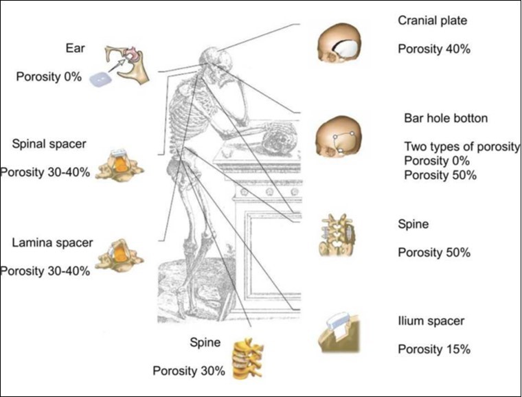 A schematic drawing presenting the potential usage of bioceramic scaffolds with various degrees of porosity. Reprinted from Ref. 66 with permission.
