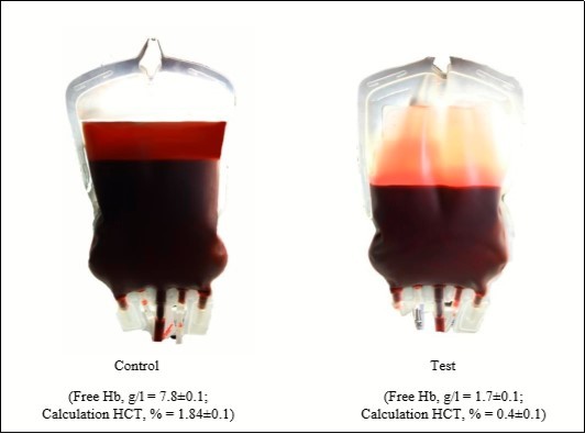 The hemolysis inhibition effect with using method of additive modernization of preservative solutions adapted to the manufacture process at stage VI of the study.