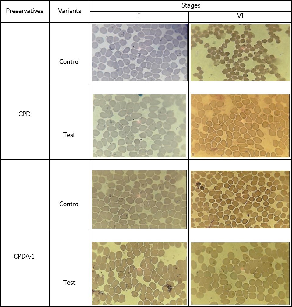 The microscopic examination of the morphology of erythrocytes in different variants of preservation and treatment.