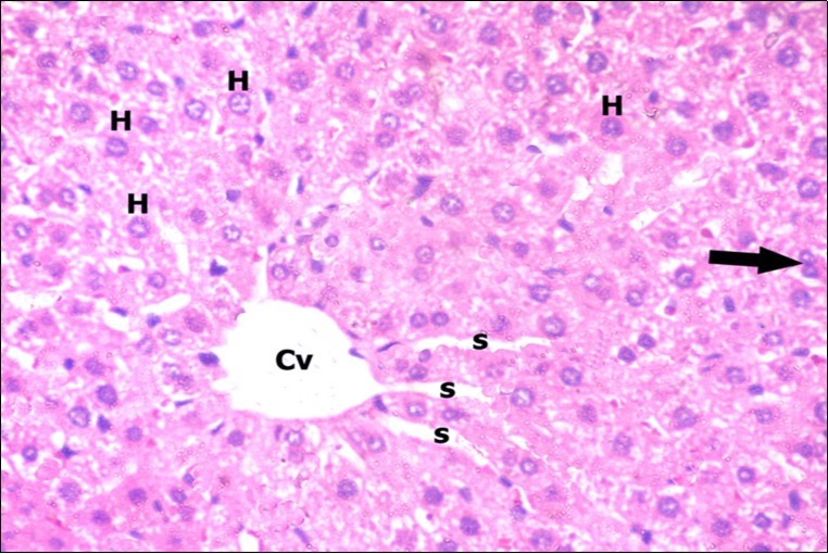 A photomicrograph of a section in the liver of a control adult albino rat showing polygonal hepatocytes (H) radiating from central vein (Cv) with rounded vesicular nuclei and acidophilic cytoplasm. Narrow radiating blood sinusoids (s) in between liver cords and their lining endothelium are noticed. Binucleated cell is also seen (thick arrow). (H&E X400)