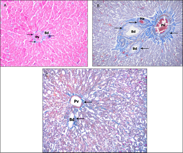 Photomicrographs of sections in the liver: (a) Control group showing normal distribution of collagen fibers (arrow). (b) ZnONPs-treated group showing abundant stained collagen fibers surrounding the portal area. (c) ZnONPs &VE- treated group showing reduction of the collagen content in portal area. (Masson’s trichrome X 200)