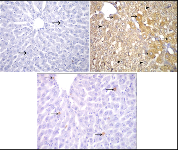 Photomicrographs of sections in the liver: (a) Control adult albino rat showing negative immune reaction for caspase 3 inside the cytoplasm of hepatocytes (arrow). (b) ZnONPs-treated adult albino rat showing strong positive immune reaction for caspase 3 inside the cytoplasm of hepatocytes. (c) ZnONPs & VE-treated adult albino rat showing weak positive immune reaction for caspase 3 inside the cytoplasm of hepatocytes. (Immunoperoxidase technique for caspase 3 X 400)