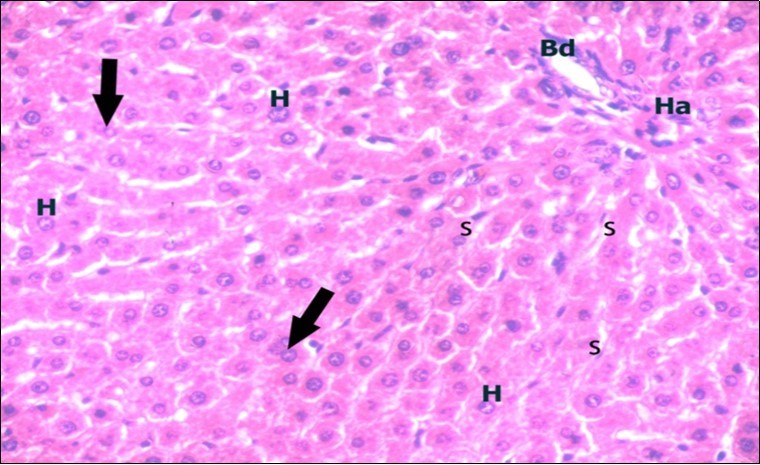 A photomicrograph of a section in the liver of a control adult albino rat showing portal area containing bile duct (Bd) and hepatic artery (Ha). Polygonal hepatocytes (H) with rounded vesicular nuclei and acidophilic cytoplasm can be observed. Narrow radiating blood sinusoids (s) in between liver cords and their lining endothelium are seen. Binucleated cells are also seen (thick arrows). (H&E X400)