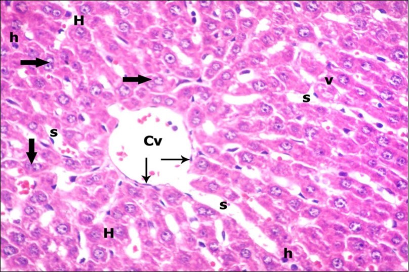 A photomicrograph of a section in the liver of ZnONPs & VE- treated adult albino rat showing slightly dilated sinusoids (s) and central vein (Cv) with flat endothelial lining (thin arrows). Most of hepatocytes are with vesicular nuclei and acidophilic cytoplasm (H). Others show darkly-stained nuclei (h) and less vacuolated cytoplasm (v). Binucleated cells (thick arrows) are also seen. (H&E X400)