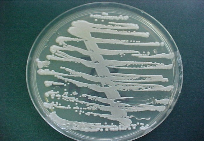 Macroscopic aspect of Saccharomyces kluyveri isolated from blood culture.