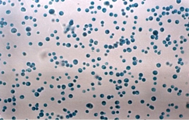 Macroscopic aspect of Saccharomyces kluyveri isolated from blood culture.