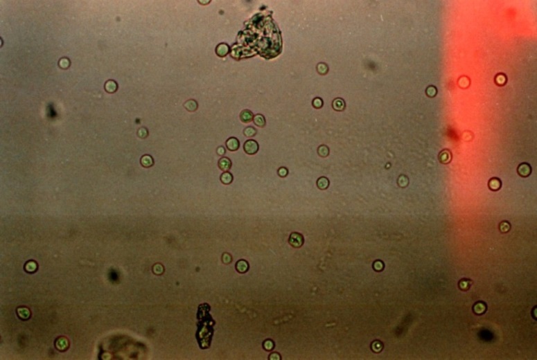 Macroscopic aspect of Saccharomyces kluyveri isolated from blood culture.