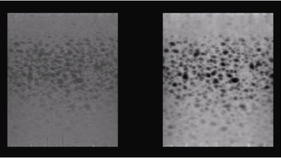 Random Void Phantom - medium contrast resolution (21.61 dB, Alloca SSD 5412). Original 3D rendered image (left), with increased image contrast (right).