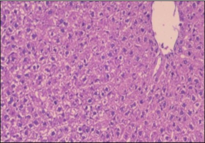 Photomicrograph of liver section of treated rat both with both fennel herb and Ator drug showing nearly normal hepatocytes (H&E) (40X).