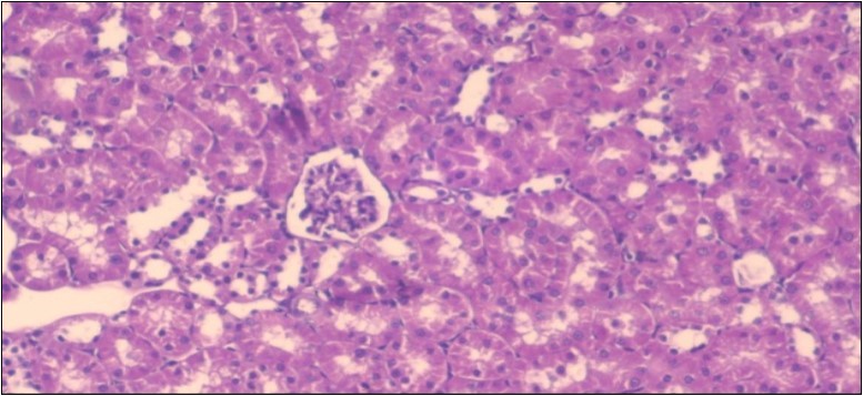 Photomicrogragh of kidney section of treated rat with fennel herb showing partial improvement in both Bowman's capsules and proximal tubules. Note the distal tubules show less focal fatty infiltration, (H&E) (40X)