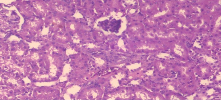 Photomicrogragh of kidney section of treated rat with Ator drug showing improvement in Bowman's capsules with normal glomerular and partial improvement in proximal tubules and distal tubules, (H&E) (40X).