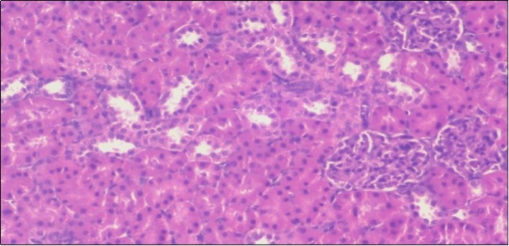 Photomicrograph of kidney section of treated rat with both fennel herb and Ator drug showing highly improved tissue with normal glomerular. Note, most Bowman's capsules and renal tubules, restoring their normal appearance (star). (H&E) (40X).