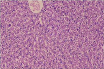Photomicrogragh of liver section of treated rat with Ator drug showing mild fatty change in hepatocytes, few hepatocytes retain is eosinophilic cytoplasm and central vein , (H&E) (40X).