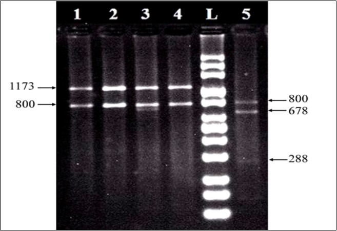 RFLP profiles of 18S nrDNAs digested with Taq I. Clade C profiles (lanes 1-4) was identified from Acropora digitifera , Acropora humilis, Acropora pharaonis, and Stylophora pistillata, while clade A (lane 5) had been identified from Pocillopora verrucosa.